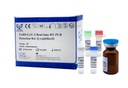 新型冠状病毒荧光PCR检测试剂盒 (冻干）